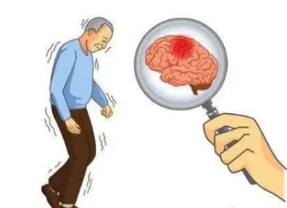 中医治疗小脑萎缩共济失调较西医有什么优势