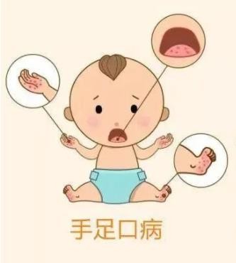 手足口病高发期警惕传染病来袭