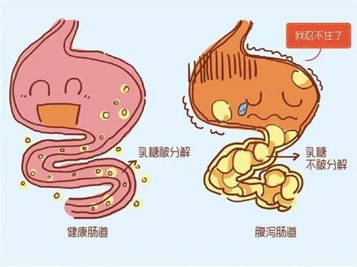 继发于各种疾病因素(如感染性腹泻,克罗恩病,肠炎,乳糜泻,短肠综合征