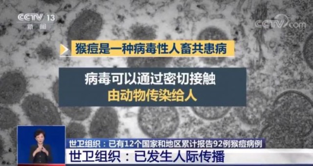 12国报告近百病例世卫组织猴痘病毒已发生人际传播拜登首次表态