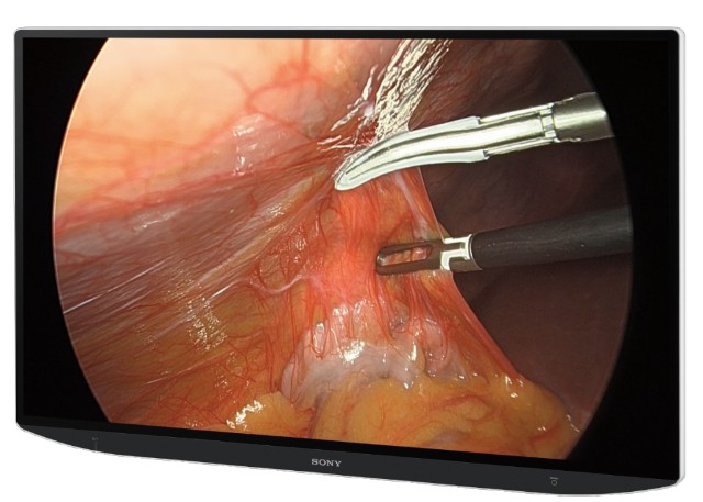 索尼医疗设备有哪些携精准影像方案亮相CMEF，索尼医疗揭秘战略布局_https://www.jmylbn.com_新闻资讯_第4张