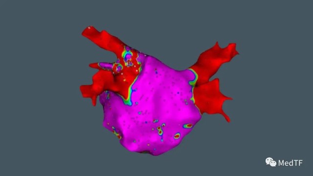 医疗MESH怎么用【MedTF盘点】MemoSorb全降解封堵器系统入选2022年十大创新医疗技术_https://www.jmylbn.com_新闻资讯_第25张