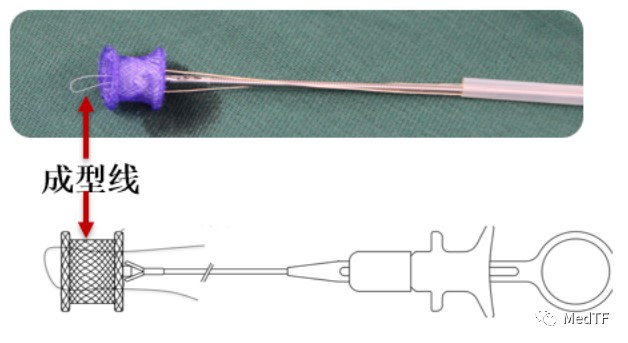 医疗MESH怎么用【MedTF盘点】MemoSorb全降解封堵器系统入选2022年十大创新医疗技术_https://www.jmylbn.com_新闻资讯_第31张