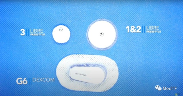 医疗MESH怎么用【MedTF盘点】MemoSorb全降解封堵器系统入选2022年十大创新医疗技术_https://www.jmylbn.com_新闻资讯_第28张