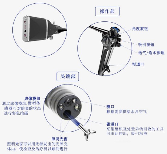 什么是软式内镜镜内镜——国产化率、渗透率快速提升的赛道_https://www.jmylbn.com_新闻资讯_第5张