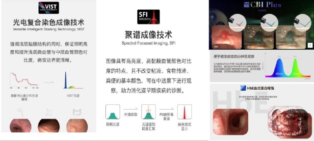 什么是软式内镜镜内镜——国产化率、渗透率快速提升的赛道_https://www.jmylbn.com_新闻资讯_第15张