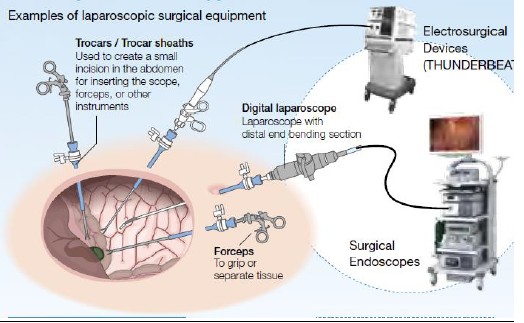 什么是软式内镜镜内镜——国产化率、渗透率快速提升的赛道_https://www.jmylbn.com_新闻资讯_第6张