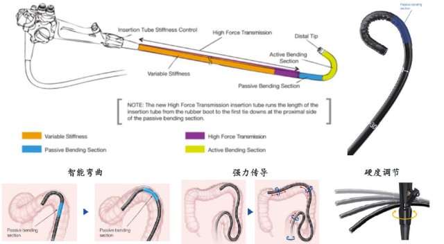 什么是软式内镜镜内镜——国产化率、渗透率快速提升的赛道_https://www.jmylbn.com_新闻资讯_第16张