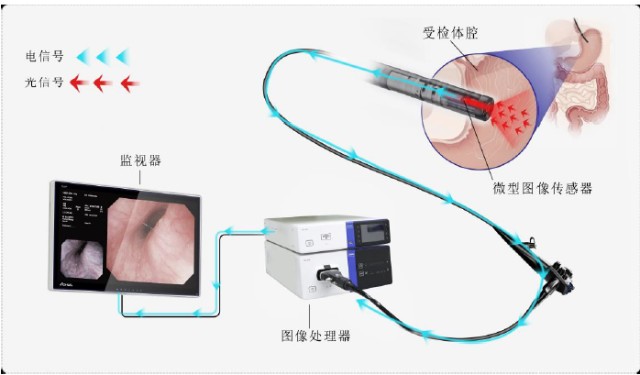 什么是软式内镜镜内镜——国产化率、渗透率快速提升的赛道_https://www.jmylbn.com_新闻资讯_第3张