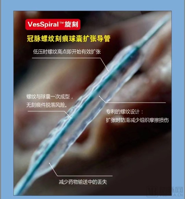冠脉螺纹球囊扩张导管获批天天向上医疗又一全球独家产品上市