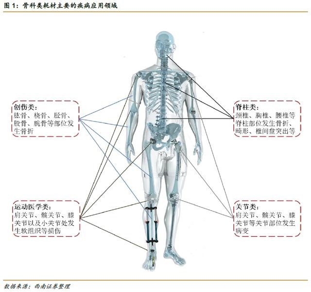 高瓴豪掷骨科赛道，一文读懂如何投资骨科细分领域