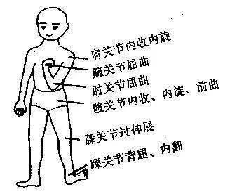 脑桥小脑萎缩患者有什么症状