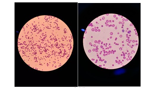 经过两周的治疗及特护,"林林"的红细胞压积逐步上升至19