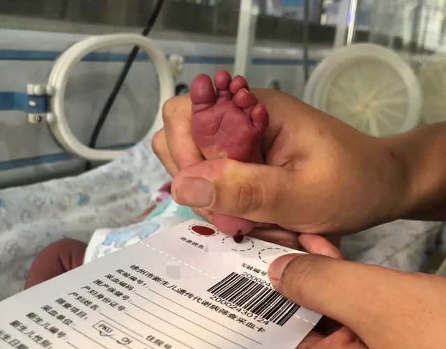 或宫内介入性治疗或手术矫治,通过采足底血,为新生儿筛查苯丙酮尿症