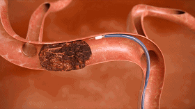 280_157gif 动态图 动图