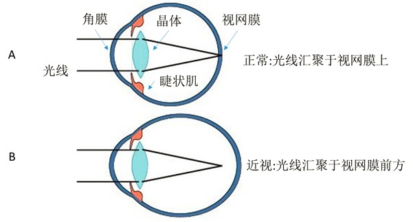 视网膜成像参数示意图图片