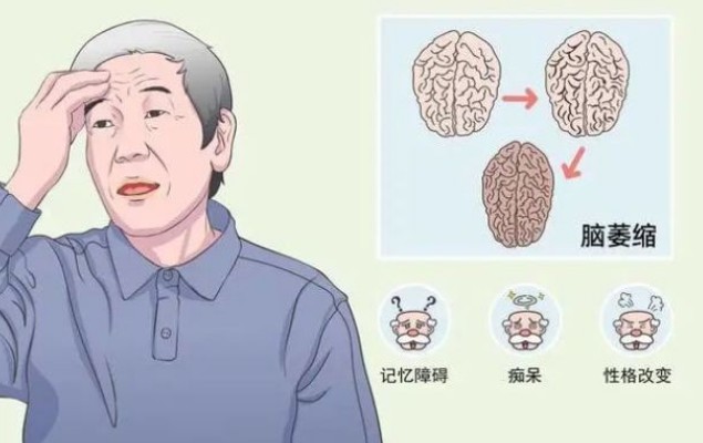 度以及眼球的旋转等也与小脑有关,所以小脑萎缩患者常出现步态不稳