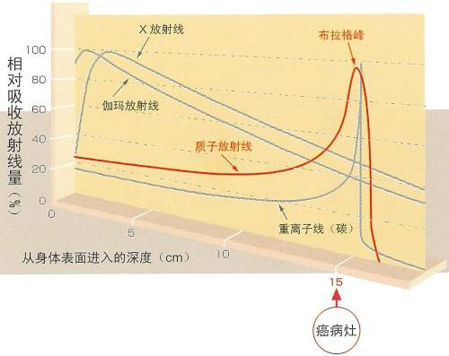 x射線,伽馬射線,質子及重離子射線相對吸收量差別重離子是比電子重的