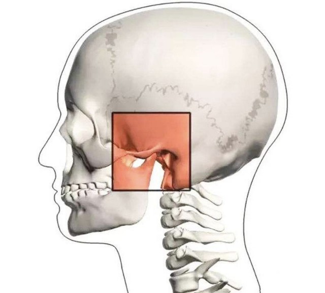 颞下颌关节脱位示意图图片