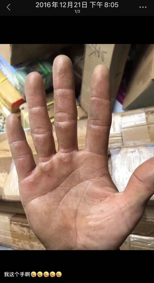 顾生强跑卡车4个月,因为装卸货,手磨出了老茧还起泡了跑车1年换新车