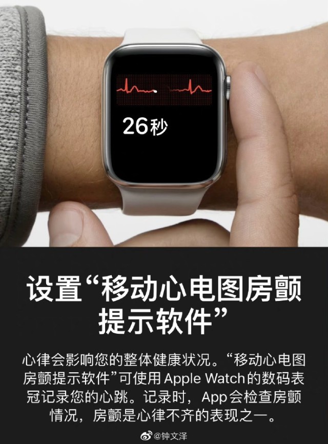 applewatch刚迎心电图完全体却遭新麻烦电池鼓包被集体诉讼