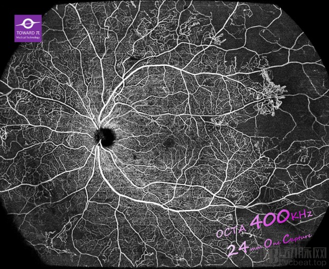 眼科医疗设备有哪些【首发】图湃医疗今年再获2亿元B轮融资，引领国产眼科设备崛起_https://www.jmylbn.com_新闻资讯_第3张