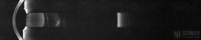 眼科医疗设备有哪些【首发】图湃医疗今年再获2亿元B轮融资，引领国产眼科设备崛起_https://www.jmylbn.com_新闻资讯_第5张