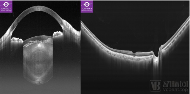 眼科医疗设备有哪些【首发】图湃医疗今年再获2亿元B轮融资，引领国产眼科设备崛起_https://www.jmylbn.com_新闻资讯_第4张