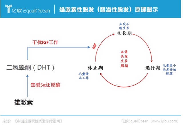 雄激素性脱发(脂溢性脱发)原理图示