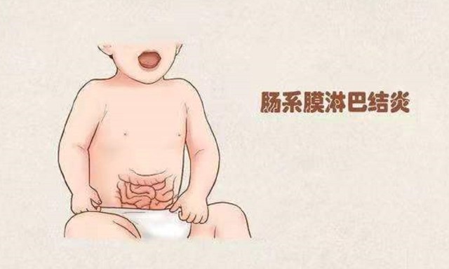 中医科姚静急性肠系膜淋巴结炎多见于7岁以下预防调护很重要
