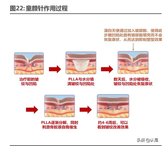 医美行业之爱美客研究报告：引领再生医美新时代