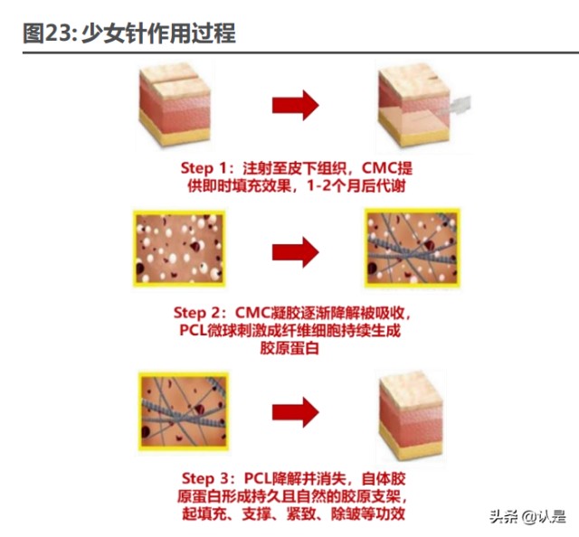 医美行业之爱美客研究报告：引领再生医美新时代