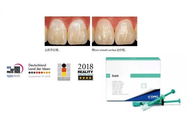 牙科DMG怎么用的德国DMG，一家来自汉堡家族牙科企业的中国情怀 ｜ 专访Rong Qing Wei_https://www.jmylbn.com_新闻资讯_第8张