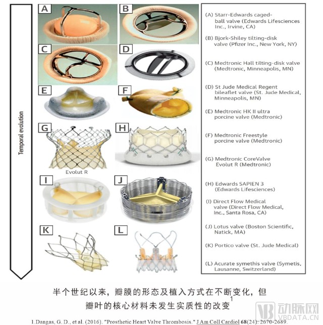 首发高分子瓣膜企业心锐医疗完成超千万元天使轮融资北极光创投独家