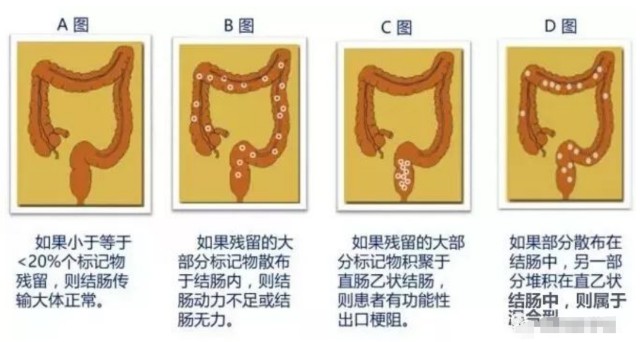 内镜医疗是什么8.3亿跨界内镜，消化药巨头被截胡？-上海聚慕医疗器械有限公司