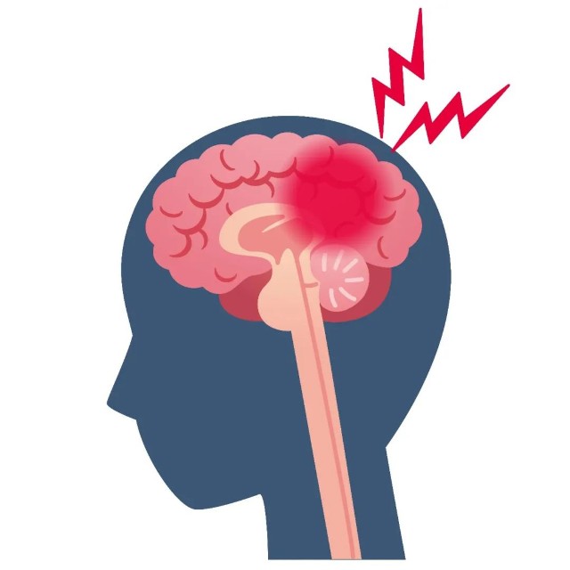 防范脑血管疾病,一级预防要做些什么?