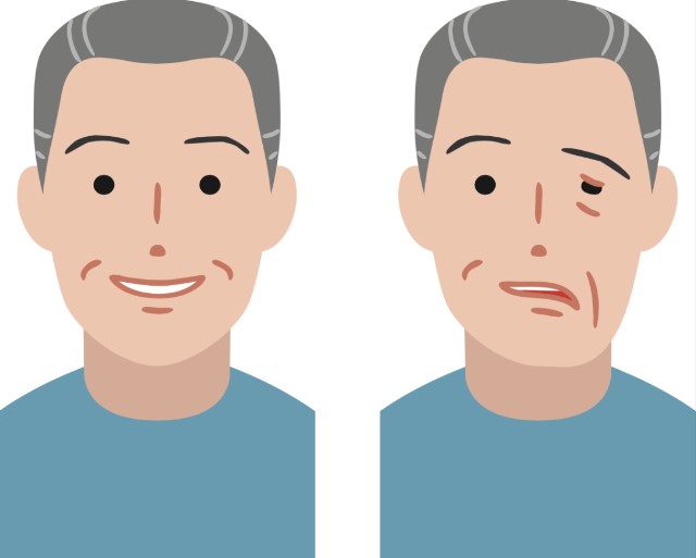 世界预防中风日|如何防中风?