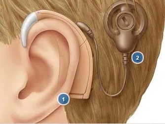 科普人工耳蜗的维护与保养