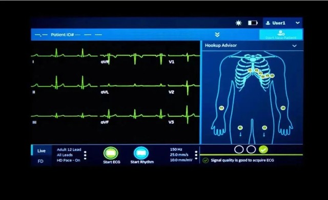 中国首发后，GE医疗如何引领国内心电图精准诊断发展？