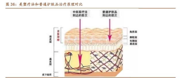 创面修复医用敷料怎么用胶原蛋白行业深度研究：四轮驱动看胶原蛋白多元发展_https://www.jmylbn.com_新闻资讯_第12张